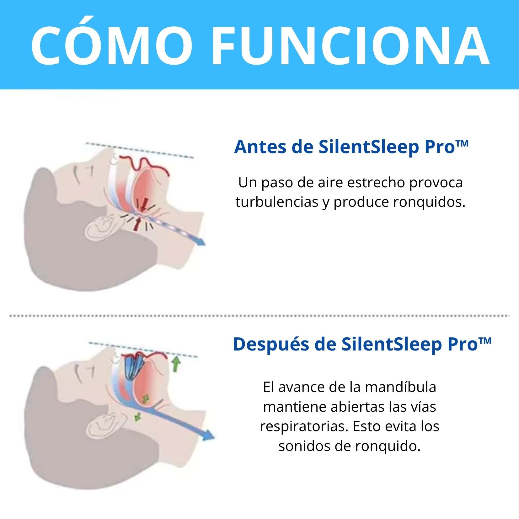 SilentSleep Pro™